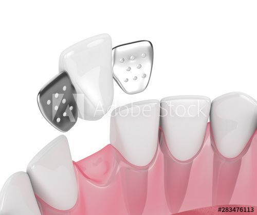 Dentures