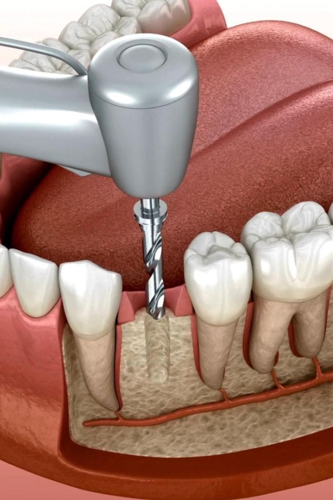 Dental Surgery